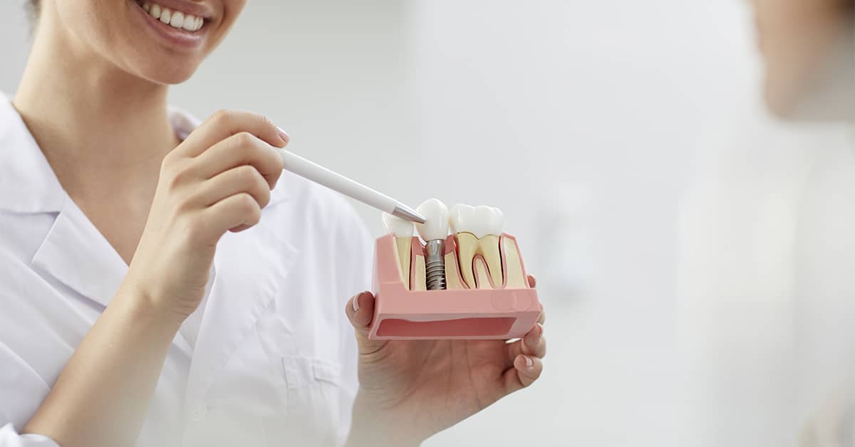 ¿Qué proceso se lleva a cabo en la implantación dental?