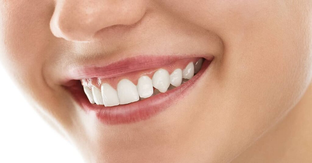 ¿cuánto tiempo puede durar un implante dental?