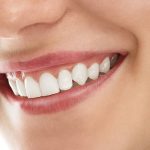 ¿Cuánto tiempo puede durar un implante dental?