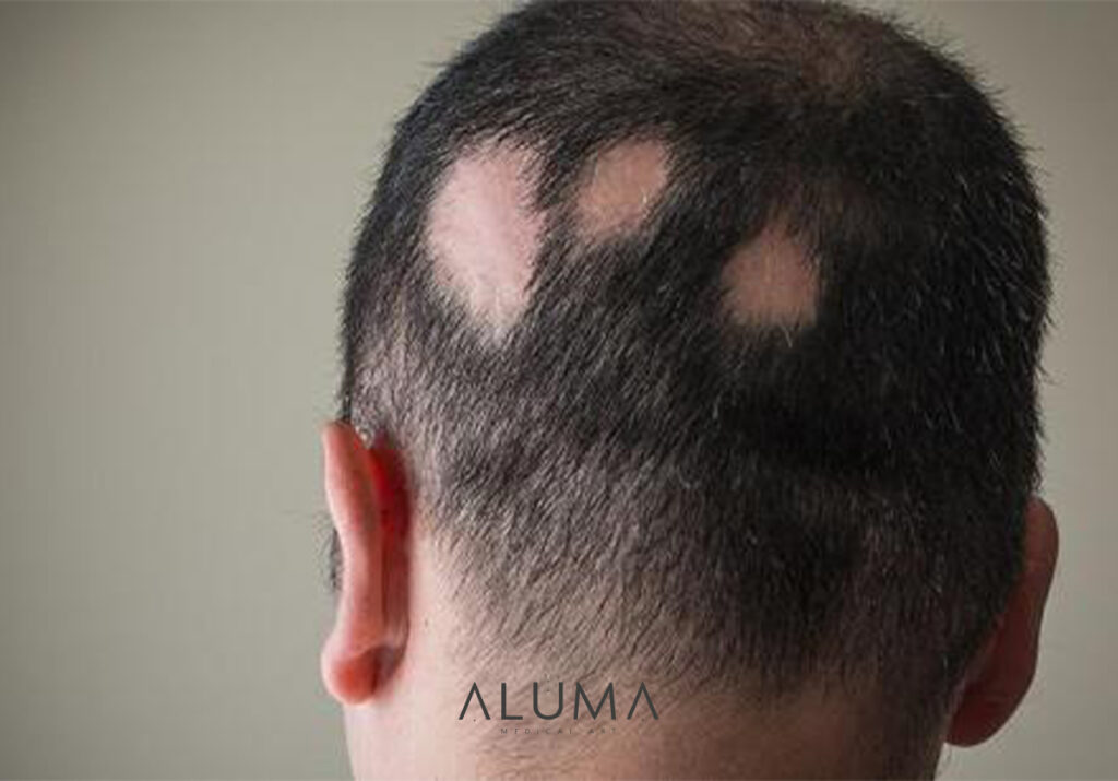 areata alumamedicalart web