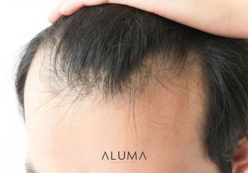 diagnósticocapilar alumamedicalart web