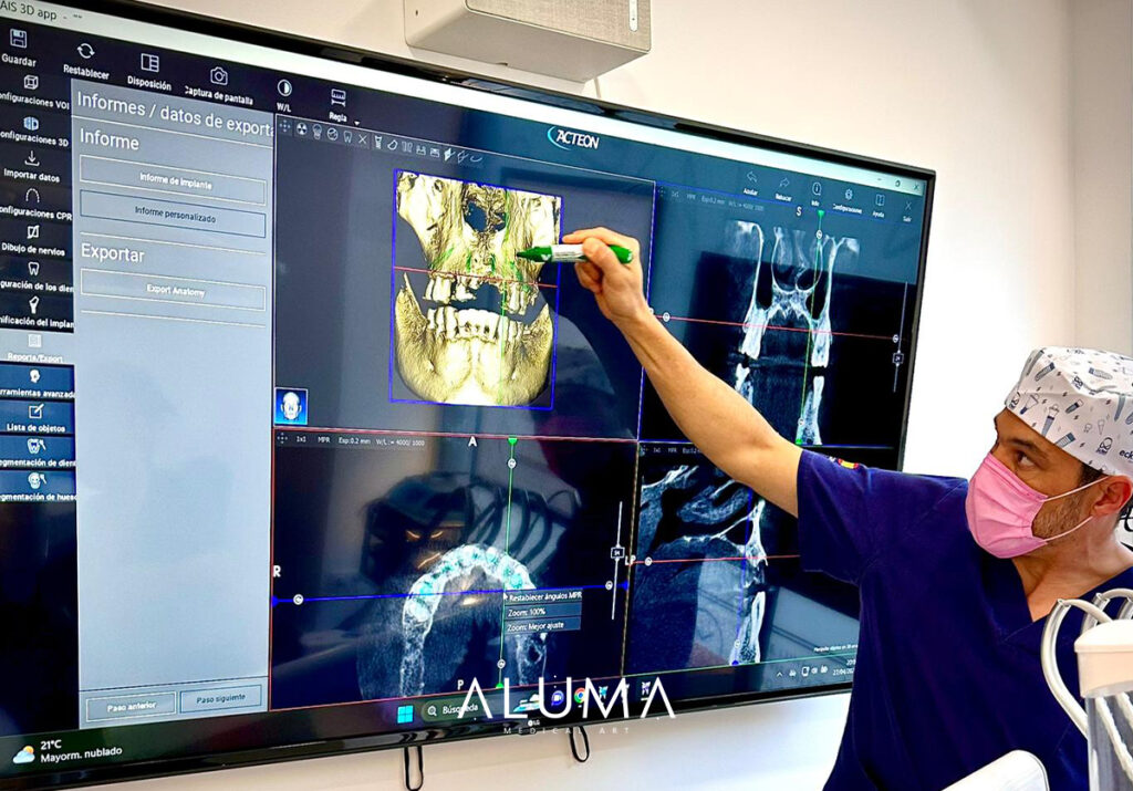 beneficiosrehabilitacionoralcompleta alumamedicalart web