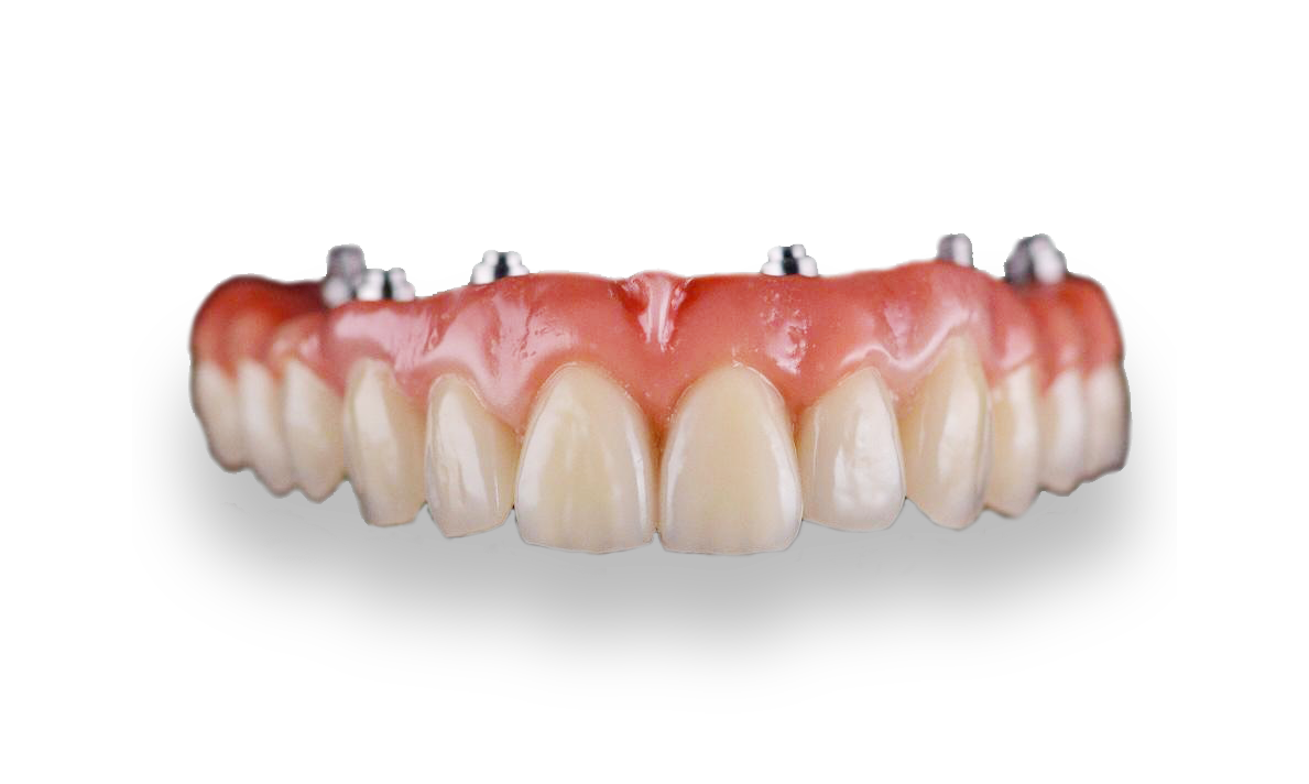 protesis oscar brandariz.png