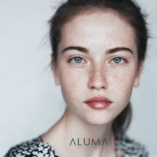 adiós a las manchas en tu piel