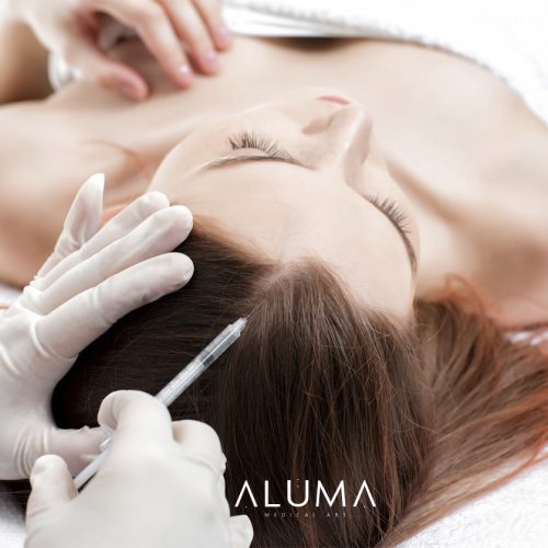 alopecia alumamedicalart web