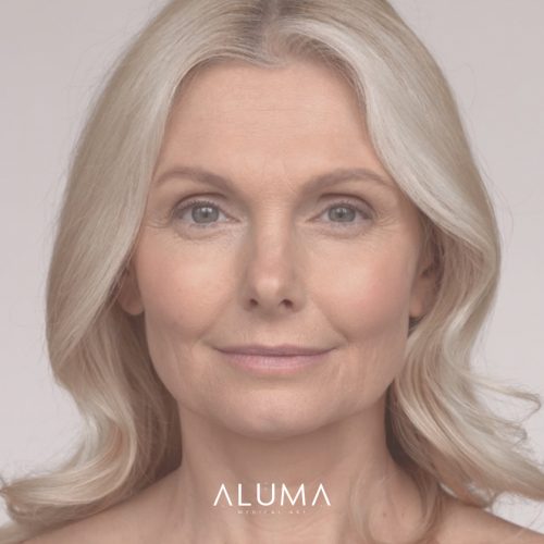 alumamedicalart neuromoduladores web