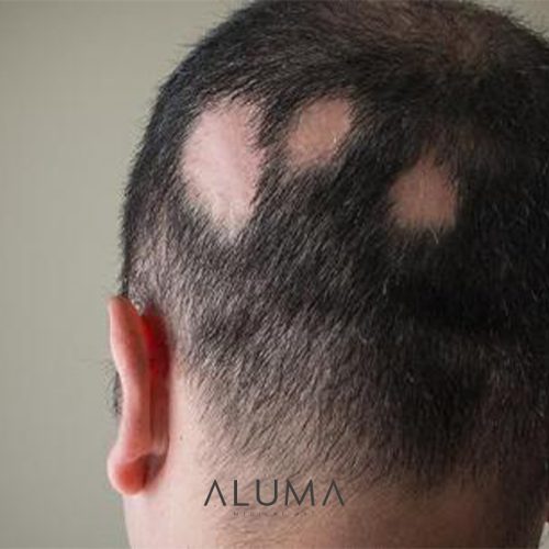 areata alumamedicalart web