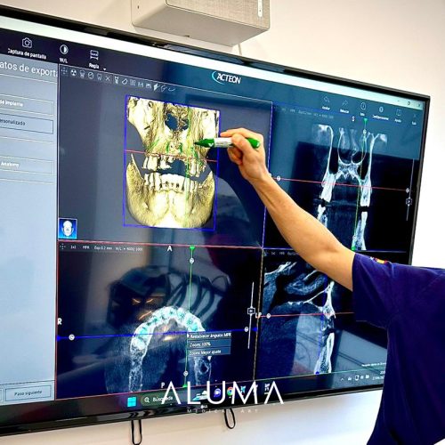 beneficiosrehabilitacionoralcompleta alumamedicalart web