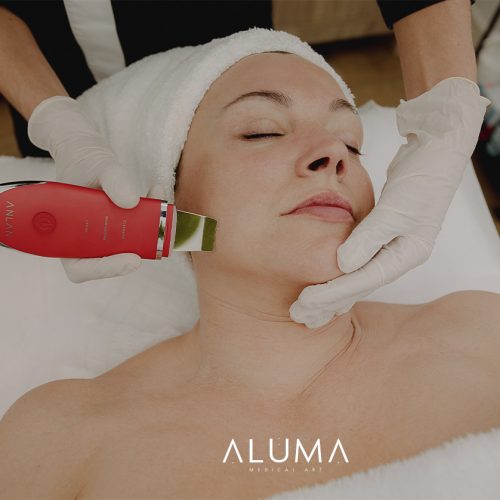 cómo tratar el acné adulto