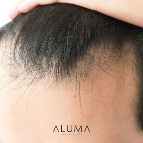 diagnósticocapilar alumamedicalart web