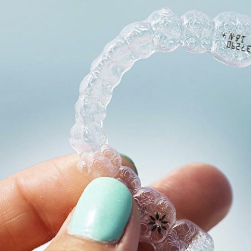 invisalign alumamedicalart post