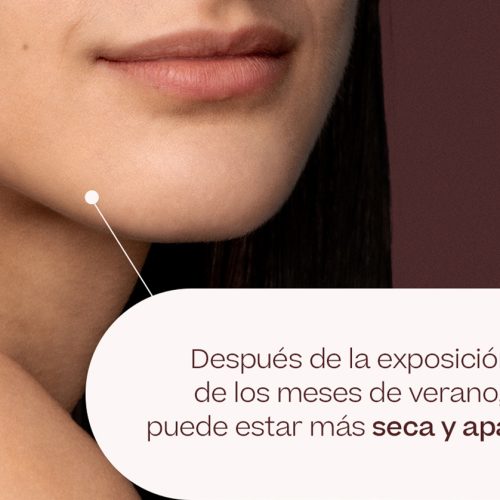 tratamientosinvierno web